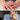 Two images showing hands with skin conditions; top image has red, irritated skin, bottom image shows a hand with a different skin condition.