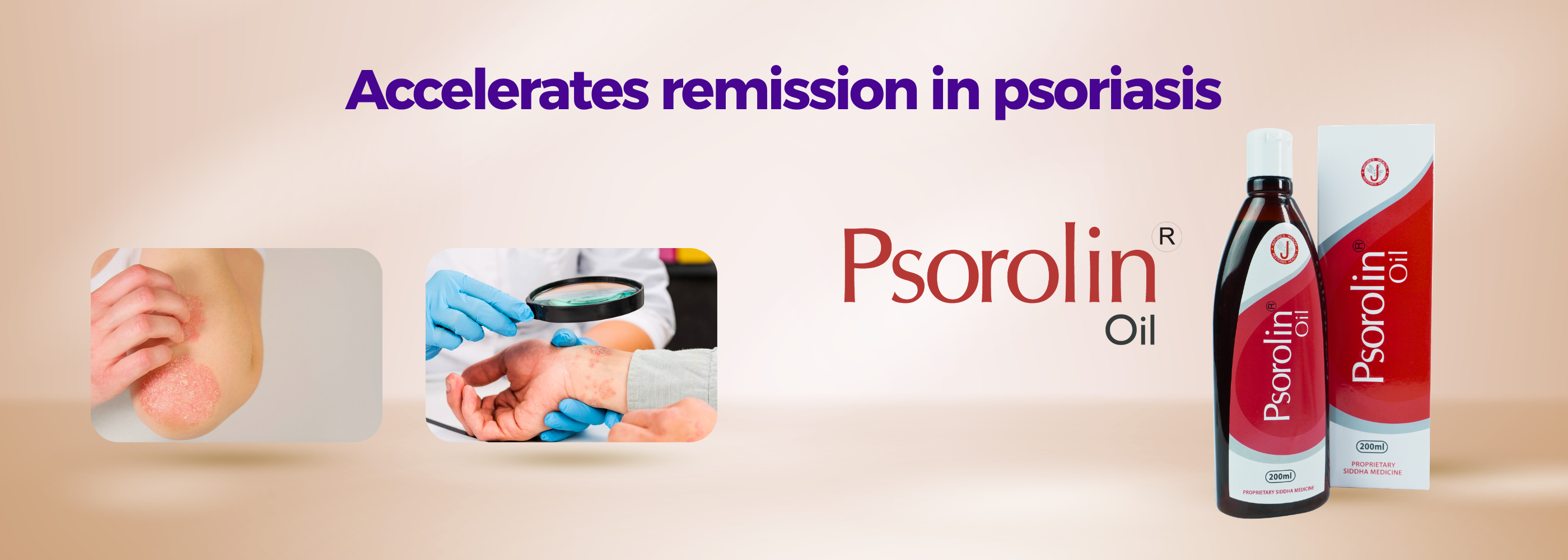 Best psoriasis oil 