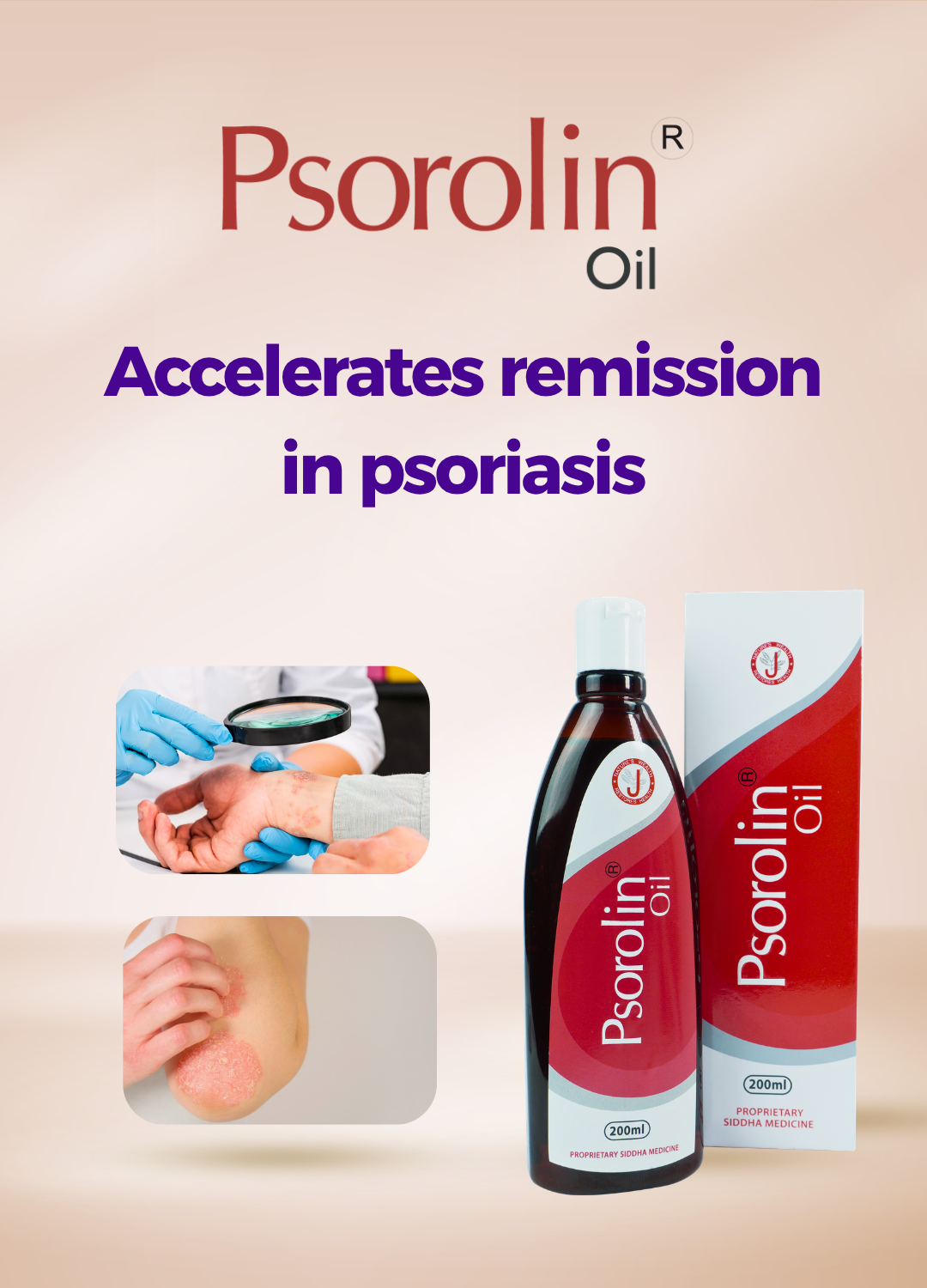 Best psoriasis oil 